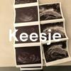 undefined Keesje