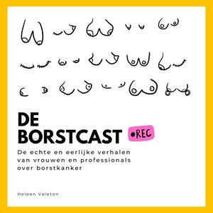 De BORSTcast